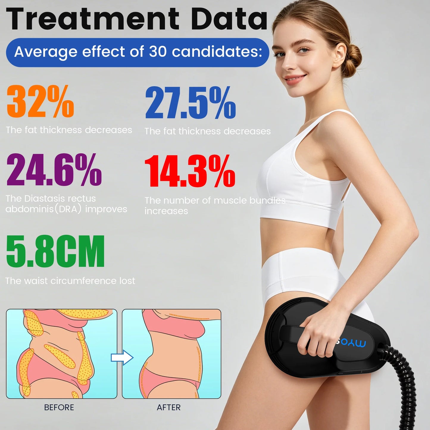 MYOSLIM 6500W EMS Body Sculpt Machine Copper Coils Touch Screen