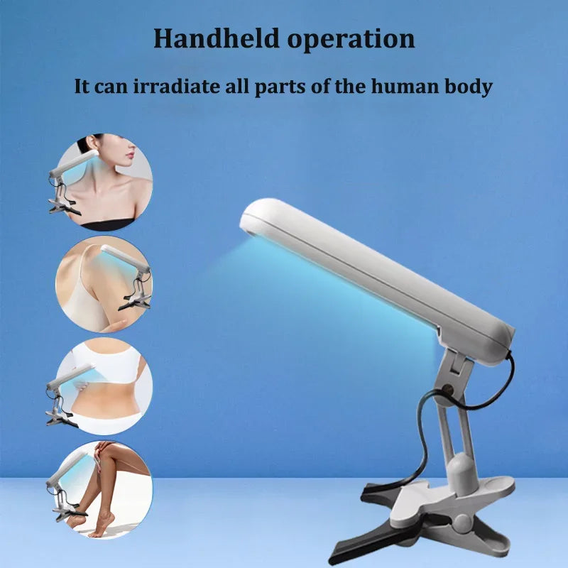 311nm UVB Lamp Phototherapy Instrument for Skin Diseases Vitiligo Psoriasis White Spots Treatment Ultraviolet Therapy Device